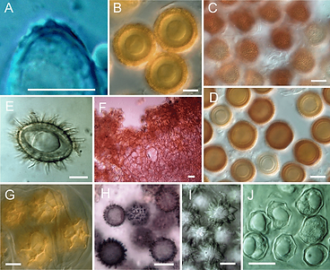 Micromorphological-features-of-selected-rare-fungi-species-observed-in-Cieszyn-A-Spore.png