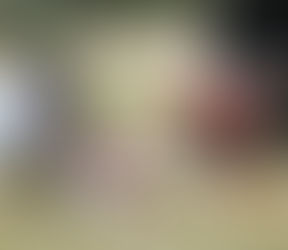 Gualaquiza: joven sufre amputación de pierna