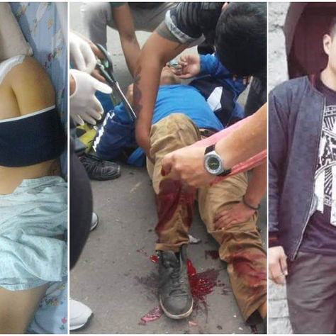 GUALACEO: AMPUTAN PIERNA DE JOVEN PADRE DE FAMILIA