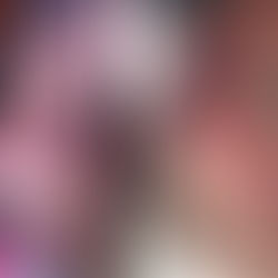 Accidente destrozó su hermoso rostro. Ahora Angélica necesita de nosotros