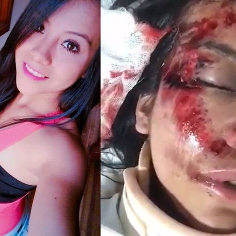 Accidente destrozó su hermoso rostro. Ahora Angélica necesita de nosotros