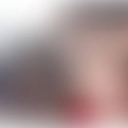 GUALAQUIZA: NIÑO EN COMA AL FRACTURARSE LA CABEZA EN CAÍDA DE COLUMPIO