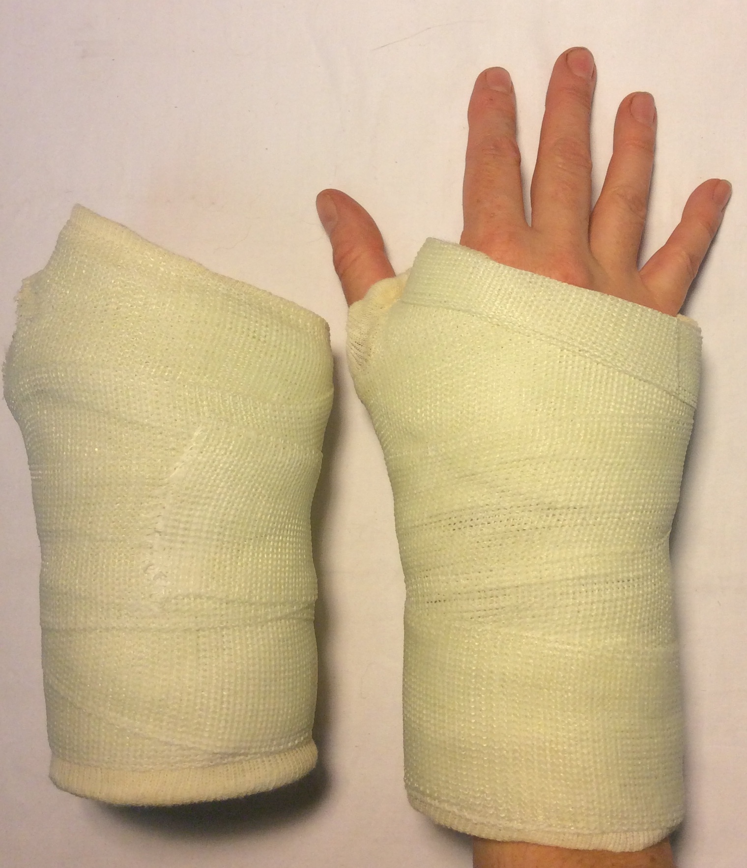 Wrist cast - adult size