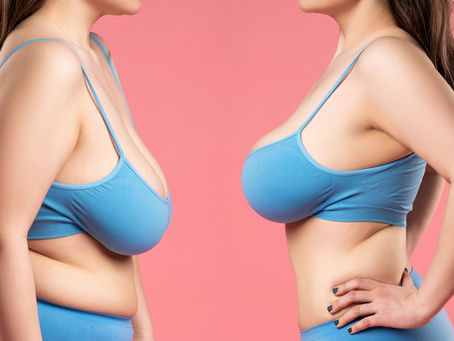 Breast Surgery: Trusted Procedures and Reputable Surgeons