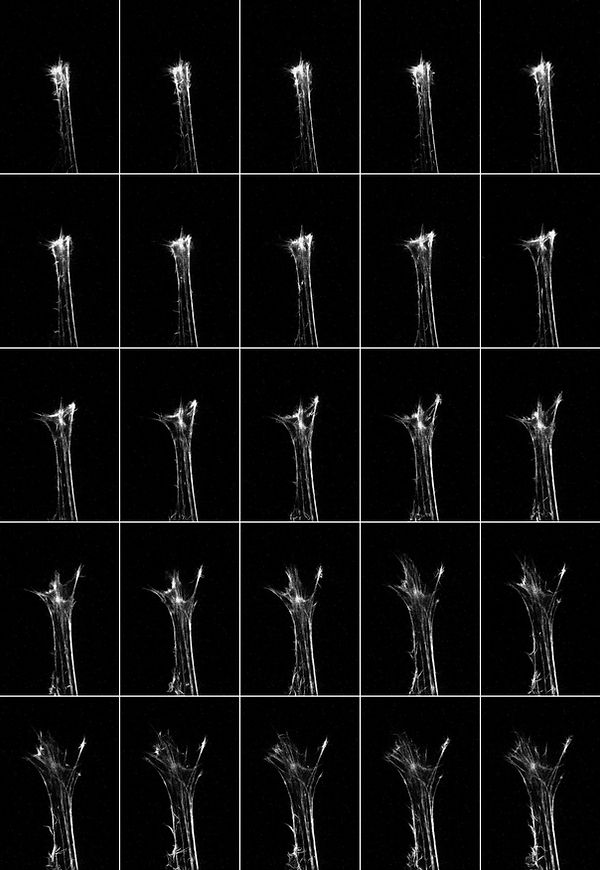 Live-cell super-resolution montage of ac