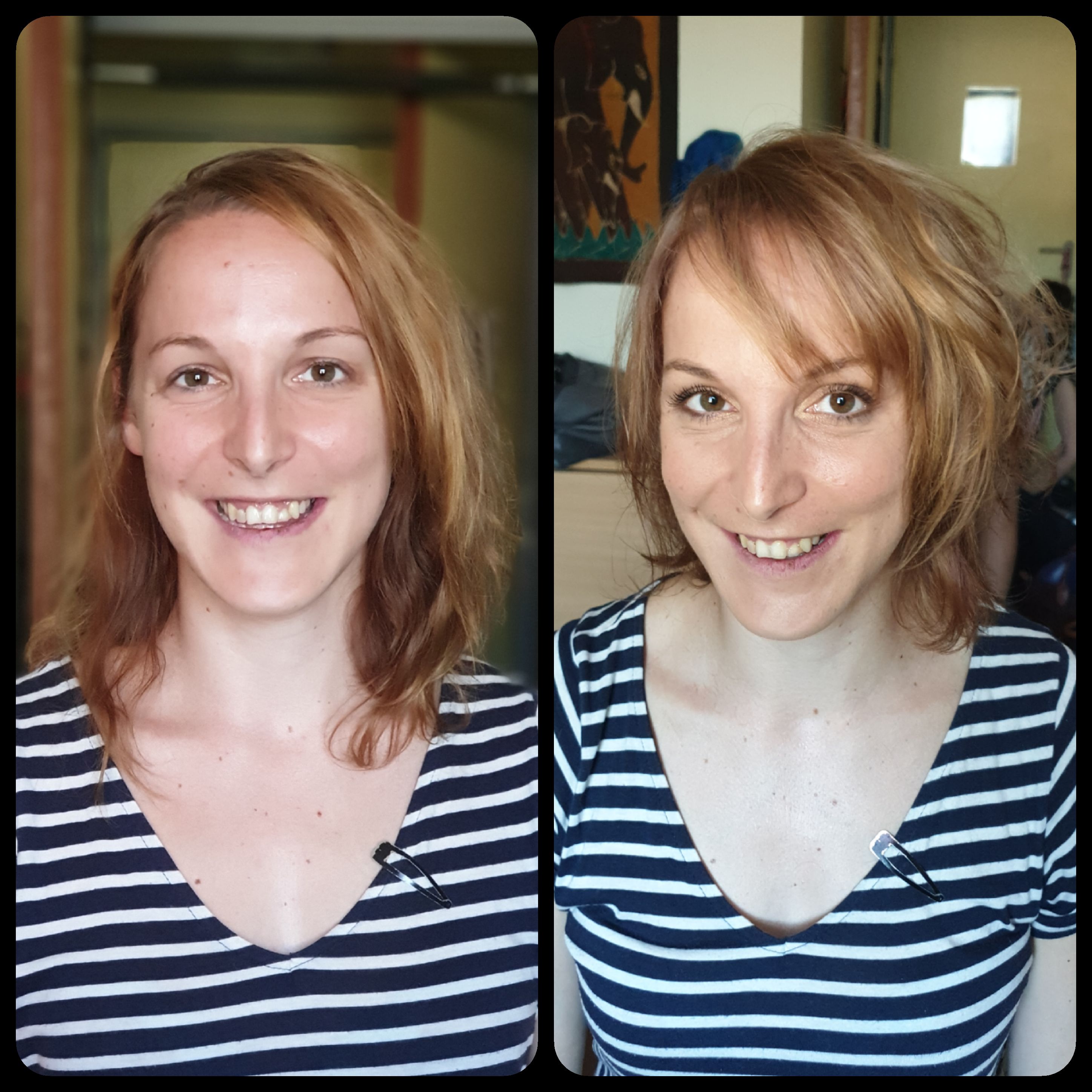 Relooking visage Strasbourg