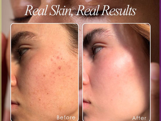 Mesoderma Aesthetic Skin Clinic