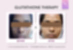 GLUTATHIONE THERAPY