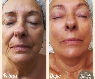 Germiniani rina fronte.jpg