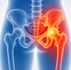 Hip pain