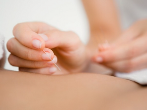  "Revitalize your muscles with the power of dry needling!"