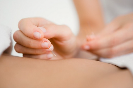 "Revitalize your muscles with the power of dry needling!"