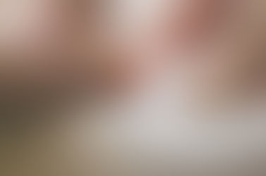 Harnessing the Power of Dry Needling to Enhance Fitness Performance