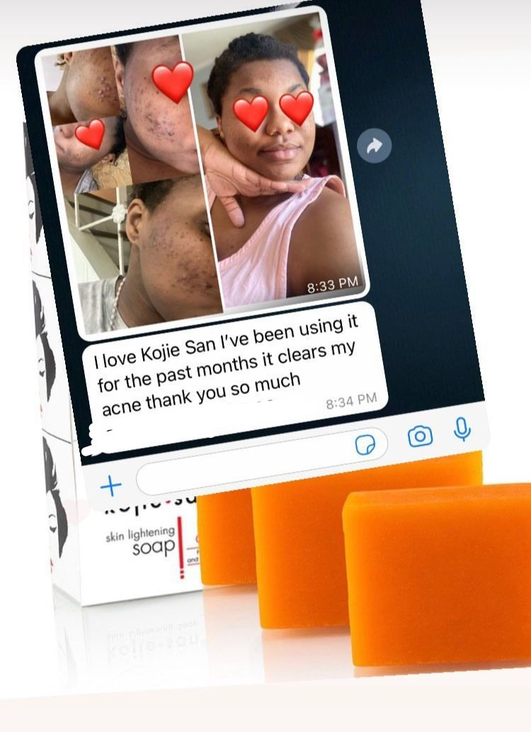 Thumbnail: Kojie San kojic acid soap
