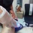 Hifu rejuvenecimiento facial no invasivo y duradero