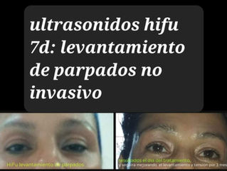 Piel sana y tensa