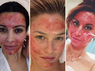 REJUVENECIMIENTO FACIAL OFERTA