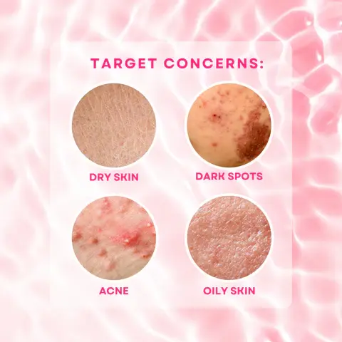 Thumbnail: BMRS Niacinamide with Glutathione Bar Soap 70g