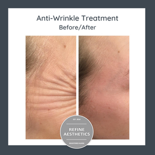 Anti-Wrinkle (2).png