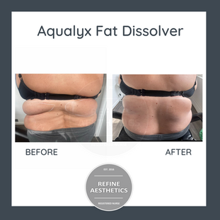 Aqualyx.png