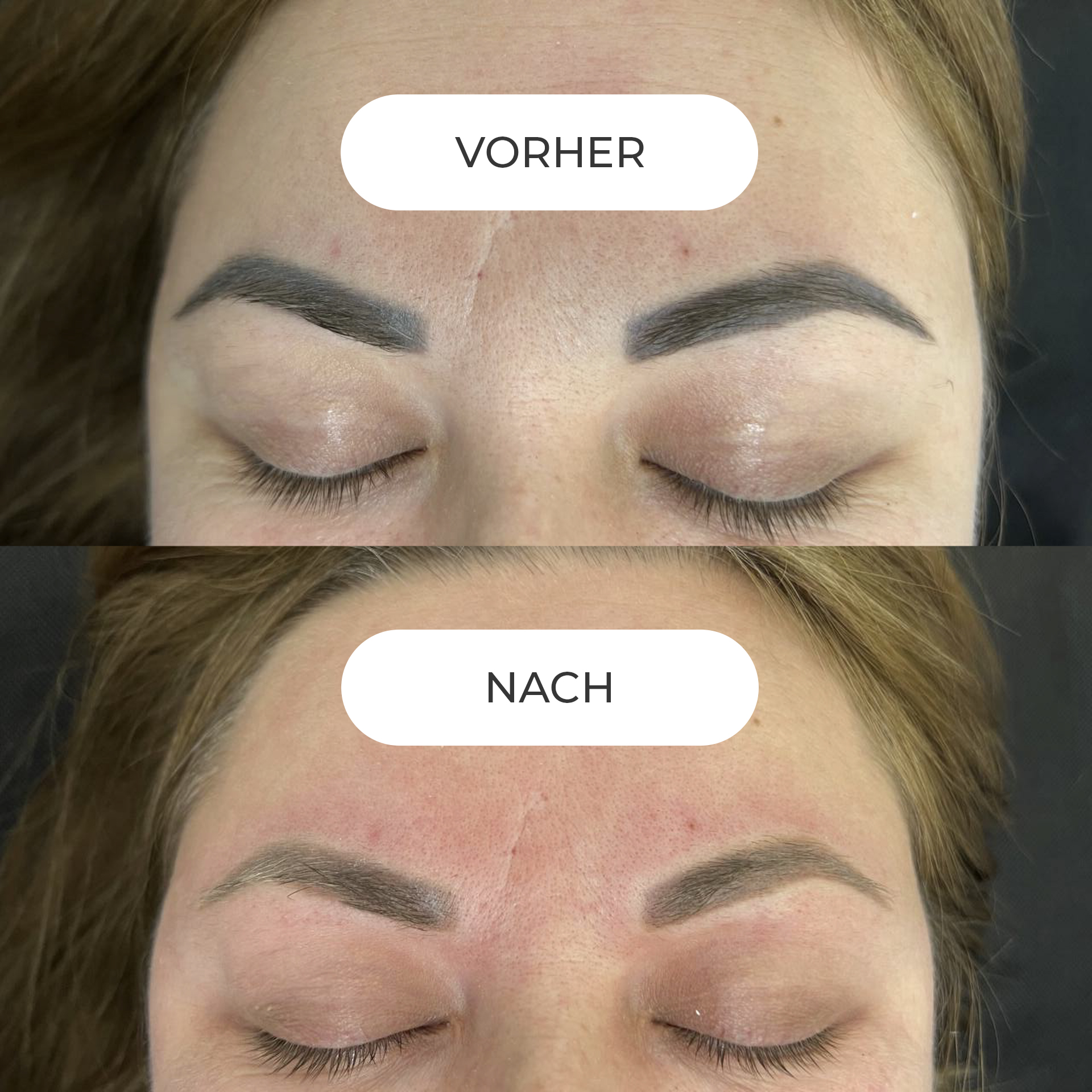 PERMANENT MAKE-UP ENTFERNUNG Sofern Ihr Permanent Make-up nicht länger Ihren ästhetischen Ansprüchen genügt