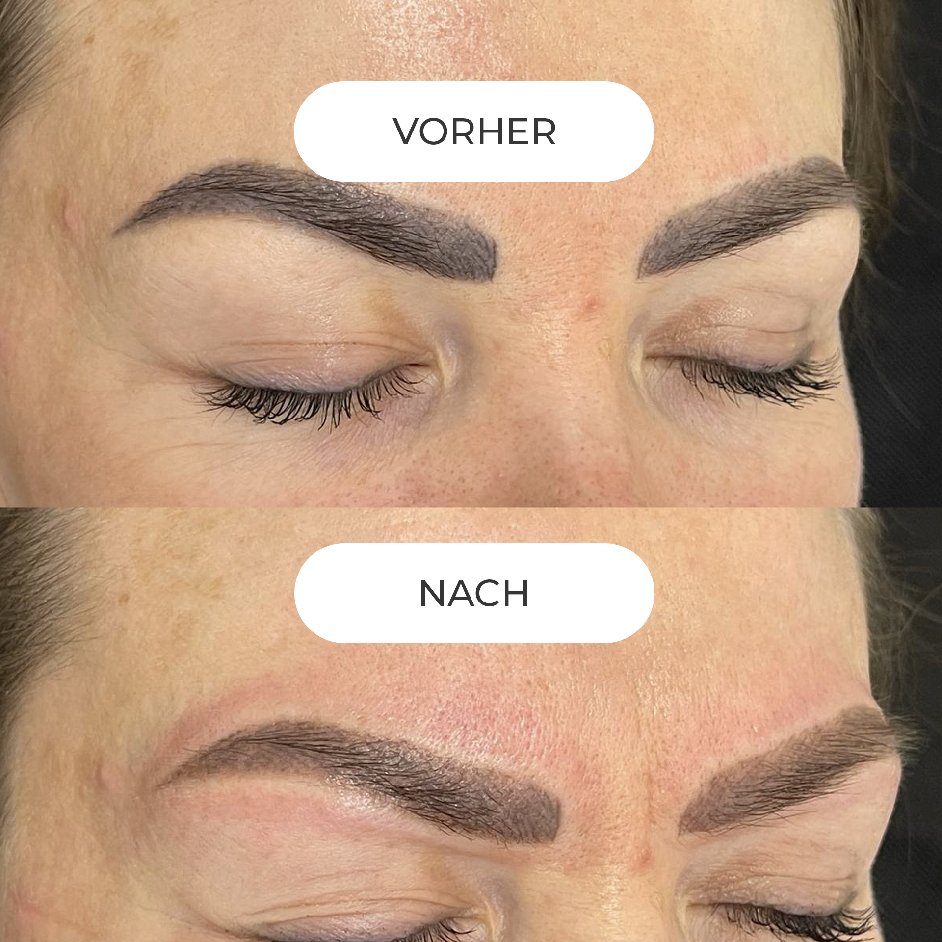 PERMANENT MAKE-UP ENTFERNUNG Sofern Ihr Permanent Make-up nicht länger Ihren ästhetischen Ansprüchen genügt