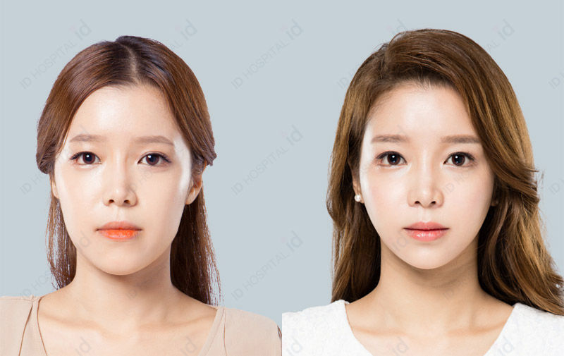 Before & After
