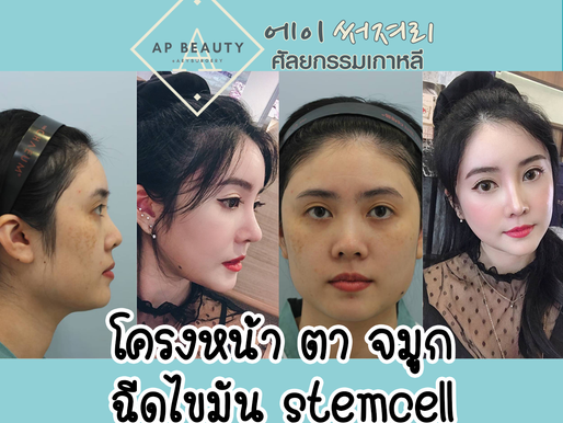 [ รีวิวศัลยกรรม ] Update1 ปี น้องยูริ โมทั้งหน้า สวยอลังเกินบรรยายเชียวค่ะ