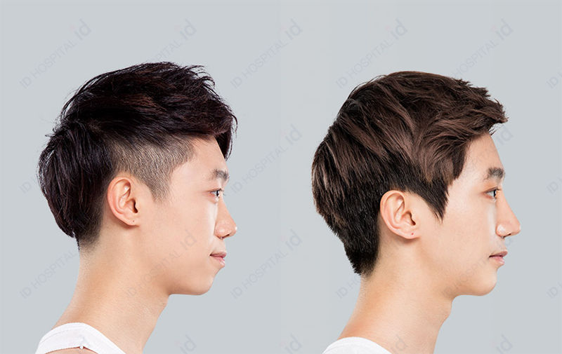 Before & After