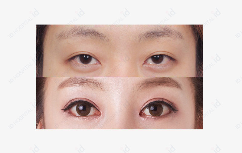 Before & After