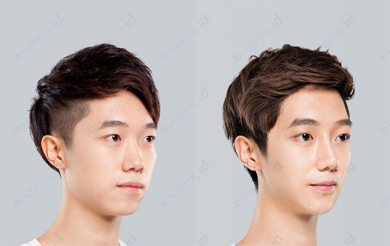Before & After