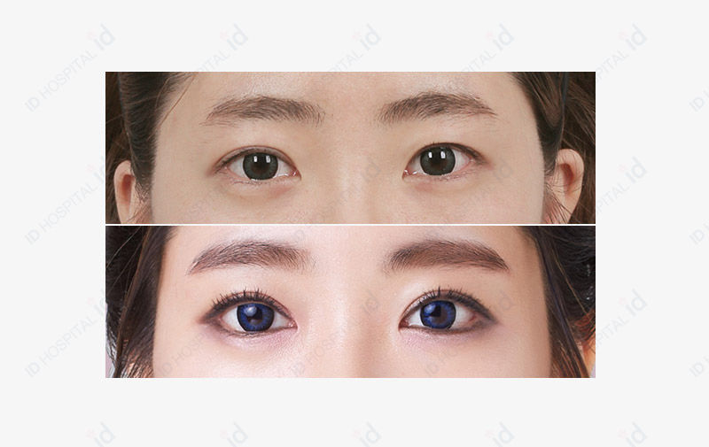 Before & After