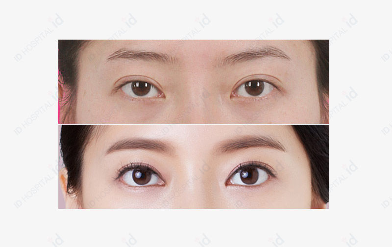 Before & After