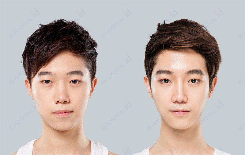Before & After