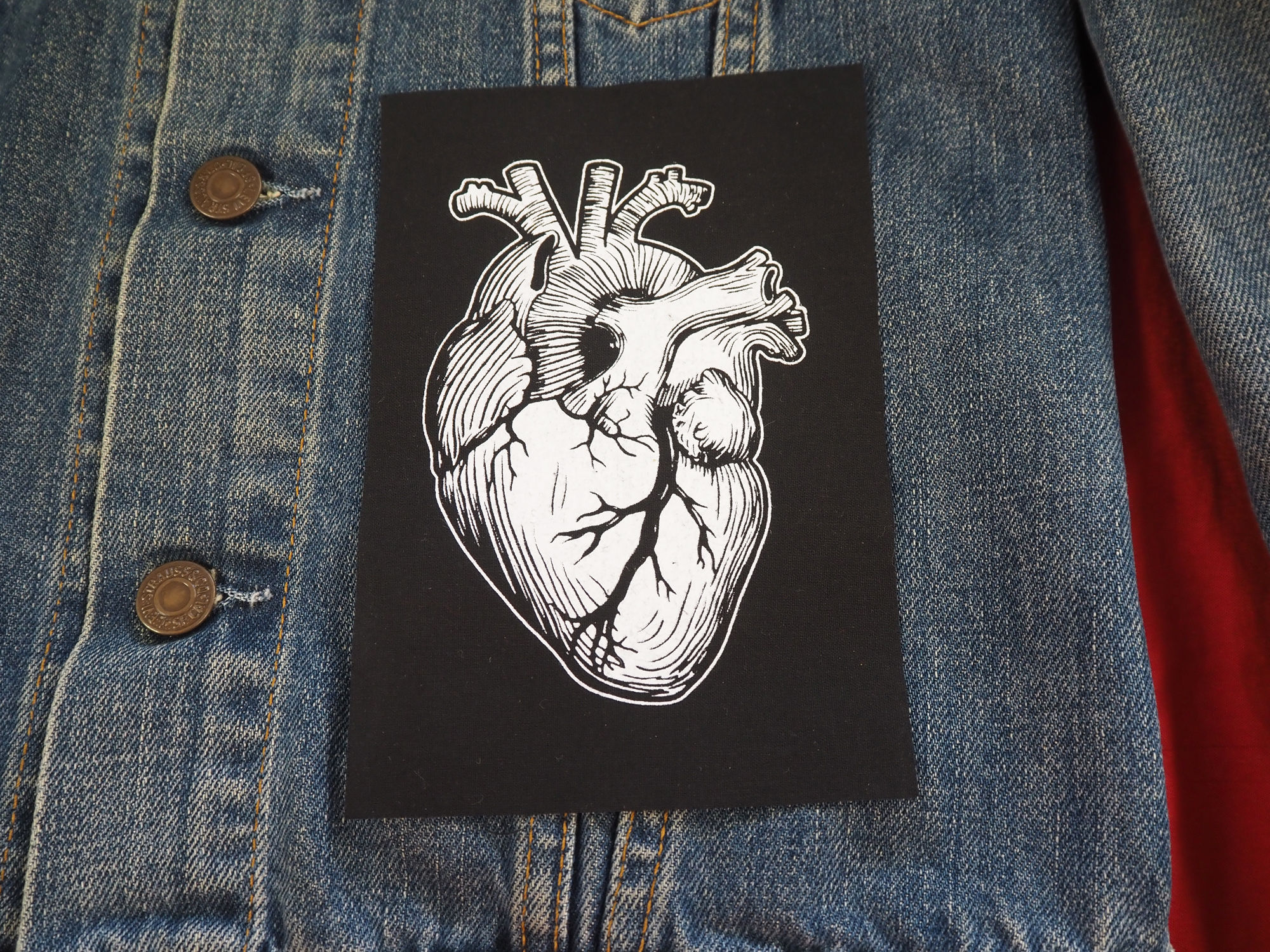Anatomical Heart Patch