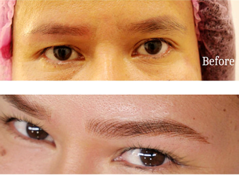 Before after PMU_edited.jpg