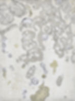 SPRING LICHEN III