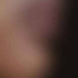 Everything I Want You to Know About Lip Filler Before You Book With Me