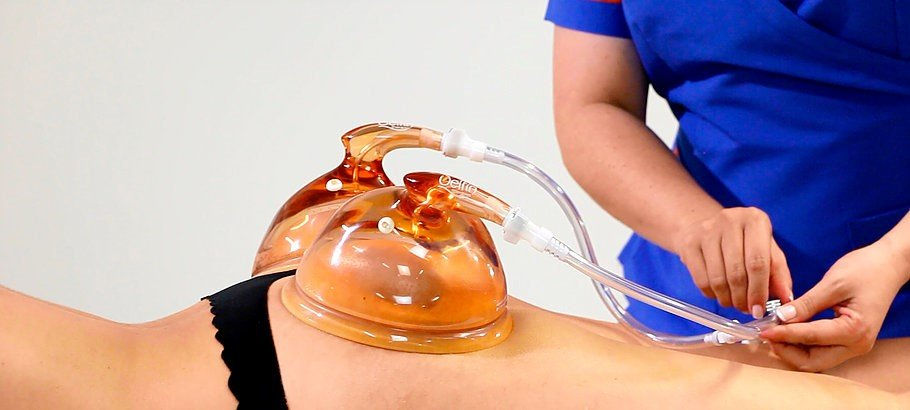 Delfin-Buttocks-Lifting-Cup-1