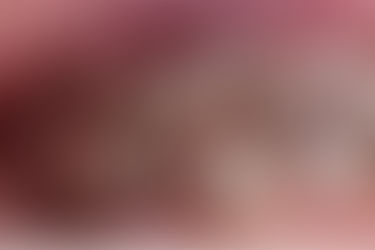 歯を抜いたままにしていませんか？