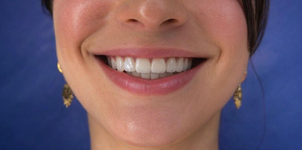 No toda zirconia es igual: Lo que debes saber antes de invertir en tu sonrisa