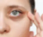 “Under Eye Treatments”.webp