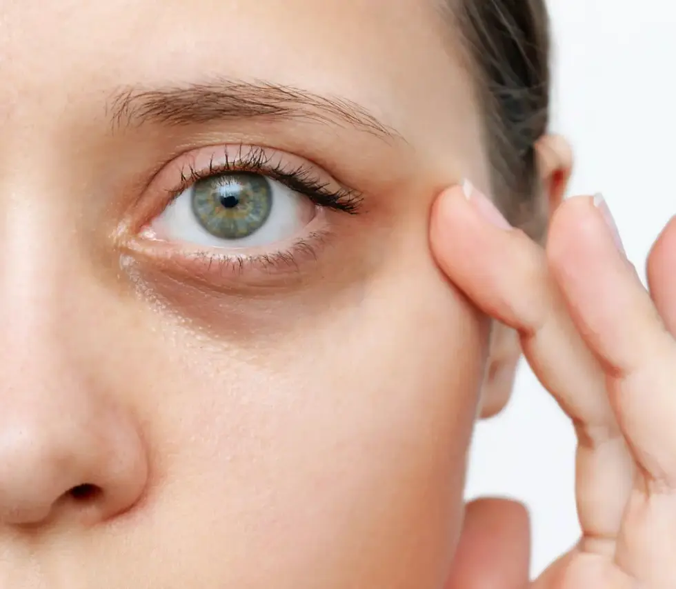 “Under Eye Treatments”.webp