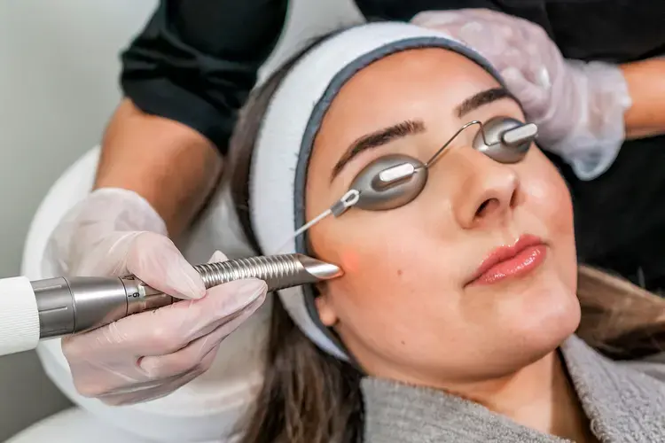 Laser Skin Rejuvenation.webp