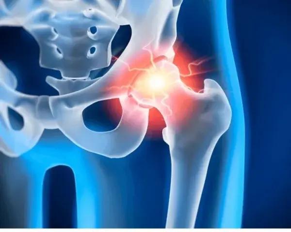 Ortho trauma.webp
