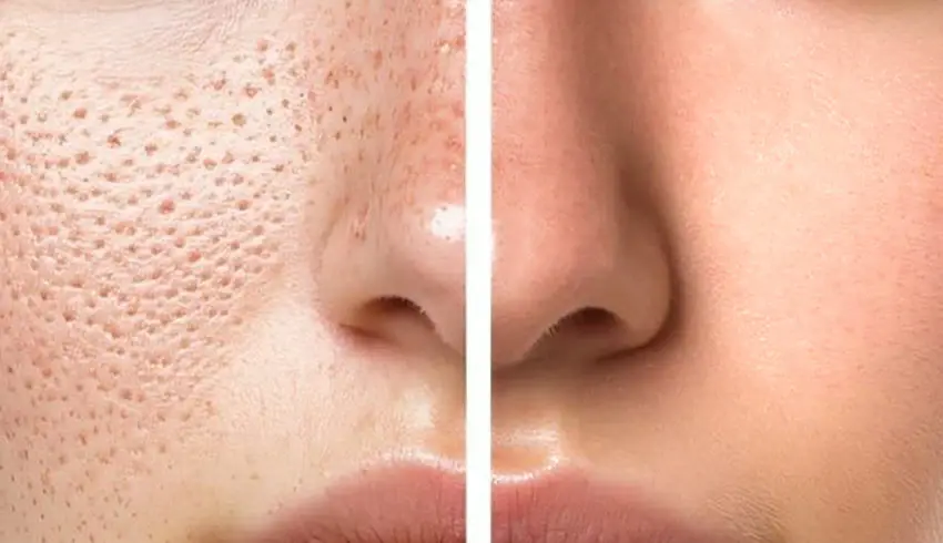 skin_blog-2_b070ded6-b90c-46ea-ac7d-7941e2e6a4c5.webp