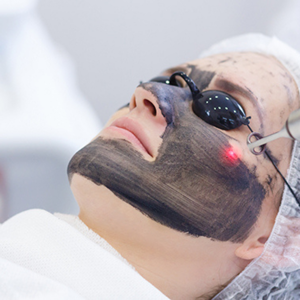 Carbon-Laser-Peel-Facial-in-Pune.png