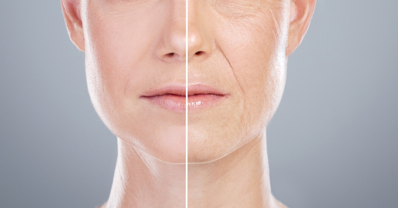 Anti-Ageing-Treatments.png