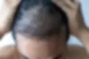 neodermatologist-20240515181601.webp