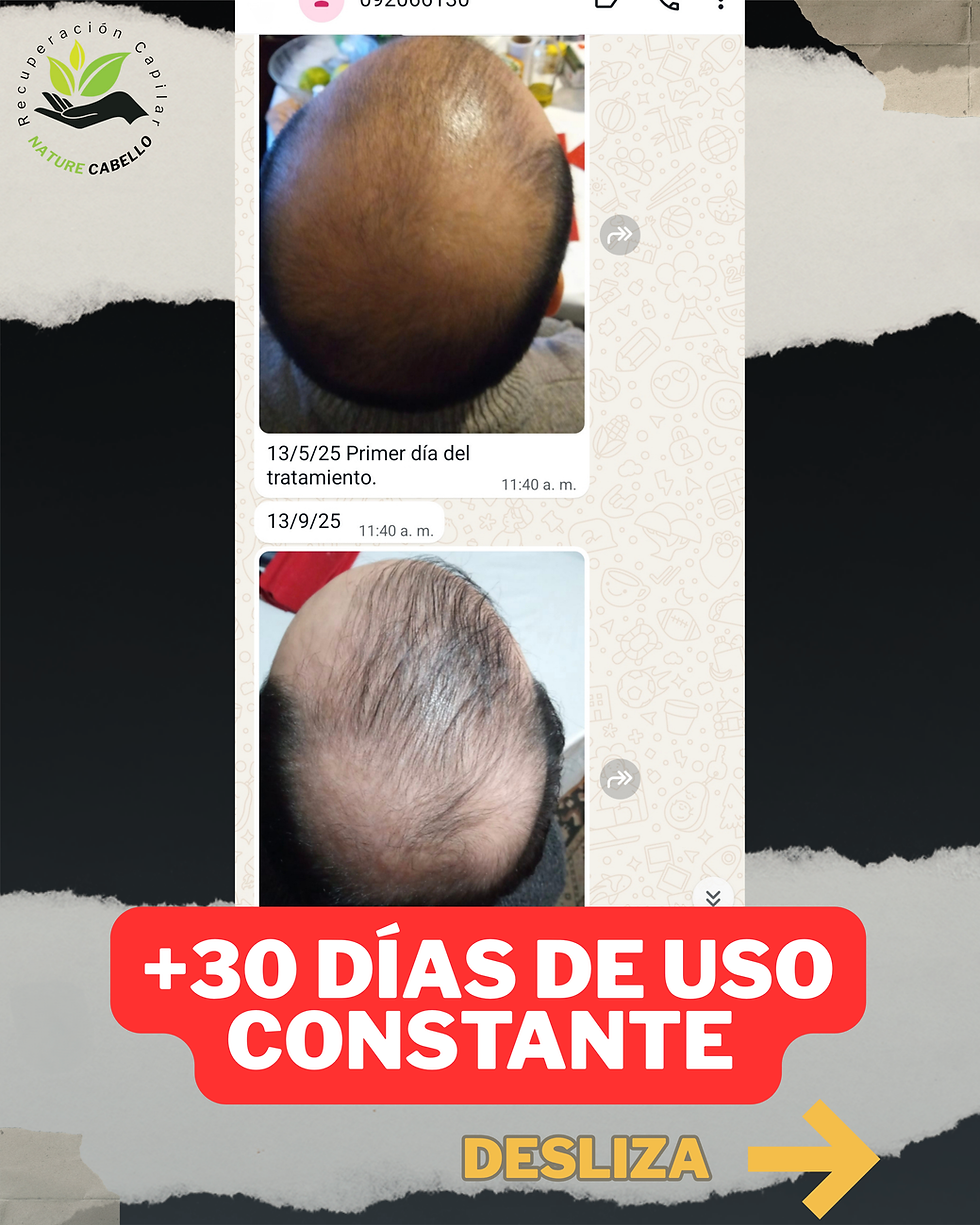 Miniatura: Minoxidil Pro (8% + Biotina)